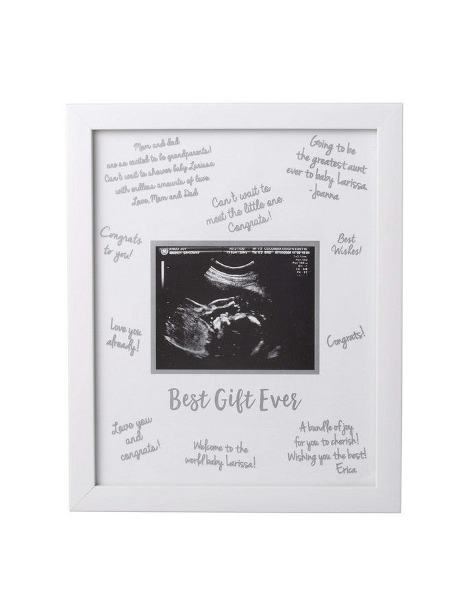 Sonogram Signature Frame Guest Book Ultrasound Picture Keepsake Gender Neutral Baby Shower Party Decor Gift For Expecting Moms Alternative Guest Book White With Included Marker