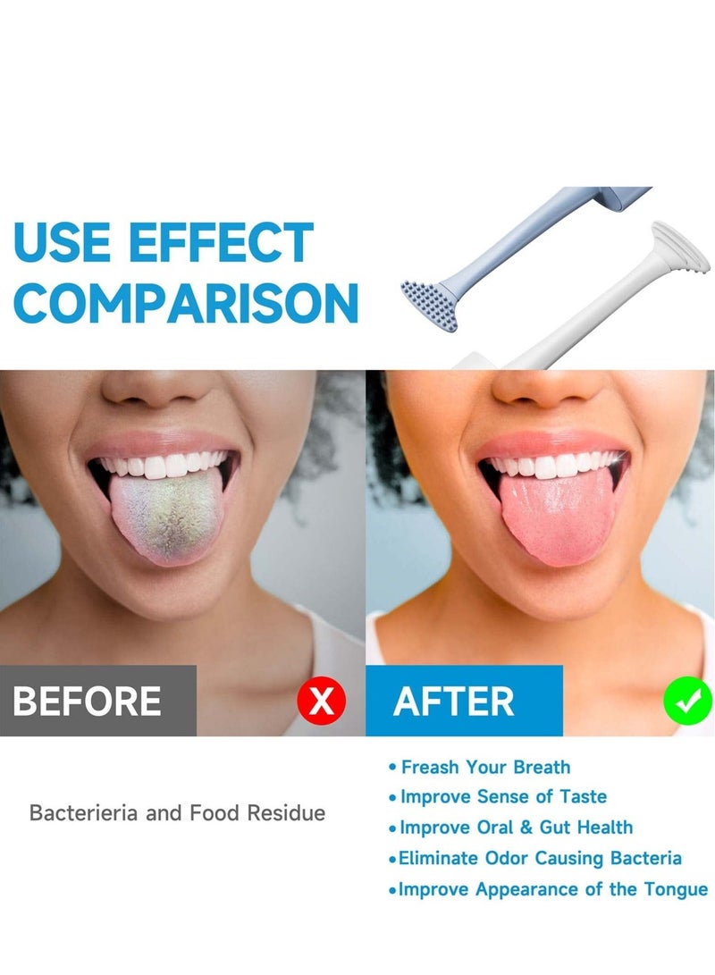 SYOSI Tongue Scraper Cleaner 100% BPA Free Scrapers with Travel Handy Case for Adults, Kids, Healthy Oral Care, Easy to Use, Help Fight Bad Breath (2 PACK White & Blue)