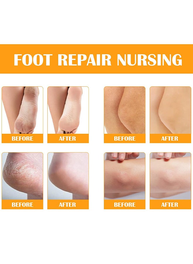 Foot Peeling Spray Oil, Foot Peeling Spray For Remove Dead Skin, Pedicure Dead Skin Exfoliator For Cracked Rough Heels, Dry Toe Skin And Calluses, Quicky Remove Dead Skin (Orange)