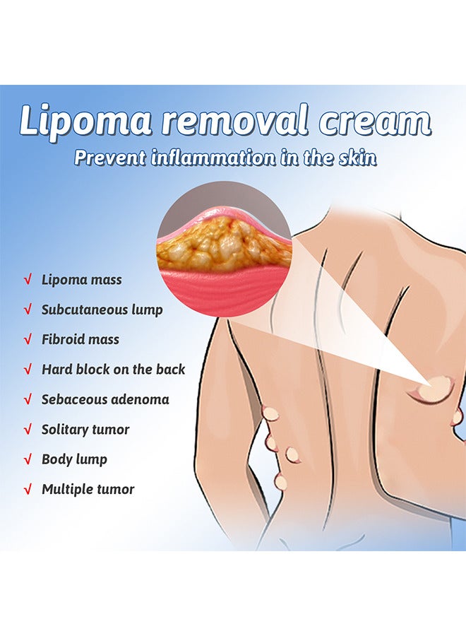 Lipoma Removal Cream, Underarm And Neck Lymphatic Care Cream, Lymphatic Drainage Cream, Anti-Cellulite Remover Cream, For Lipolysis Fat Lump Removal And Nodular Discomfort For Body And Face 50G