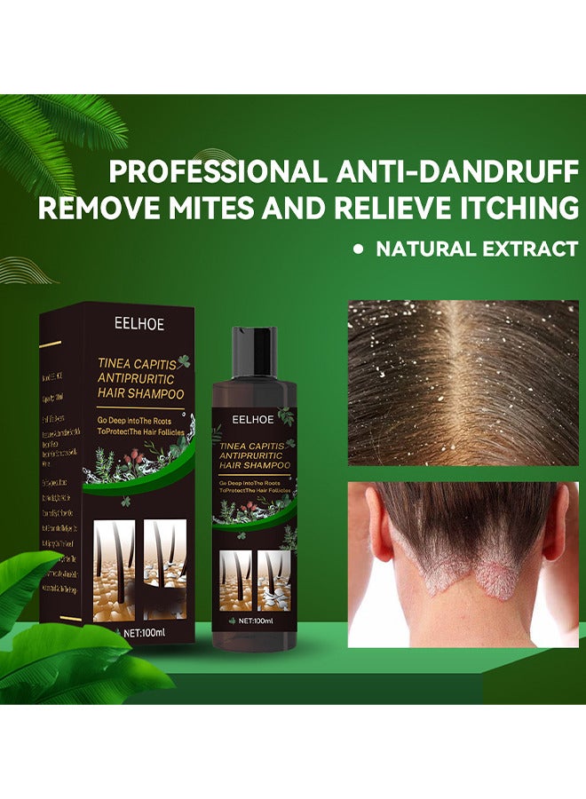 Tinea Capitis Antipruritic Hair Shampoo, Anti-Dandruff Shampoo, Shampoo For Scalp Prone To Folliculitis, Dermatitis, Dandruff, Mites, Itchy And Flaky Scalp, Treats Dandruff And Seborrheic Dermatitis