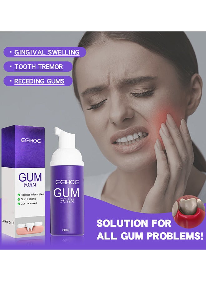 Gum Treatment Foam, Teeth Whitening Mousse, Deep Stain Cleaning Gum Treatment Foam, Gum Treatment Foam Deeply Cleaning Gums Stain Removal Reduce Yellowing 60ML