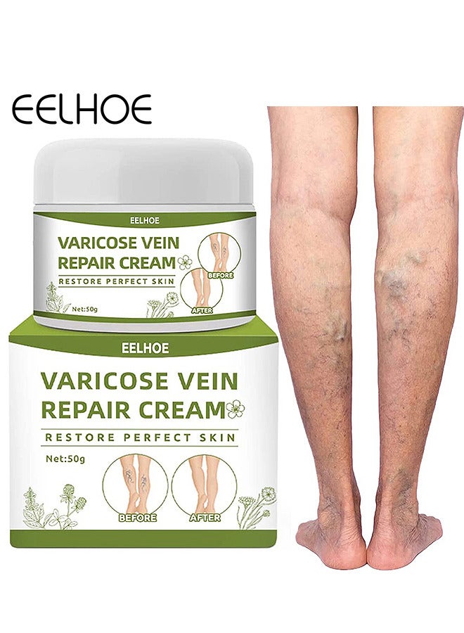 Varicose Veins Repair Cream, Spider Veins Repair Cream, Strengthen Capillary Health, Varicose Vein Treatment Cream For Legs, Improve Blood Circulation, Tired And Heavy Legs 50G