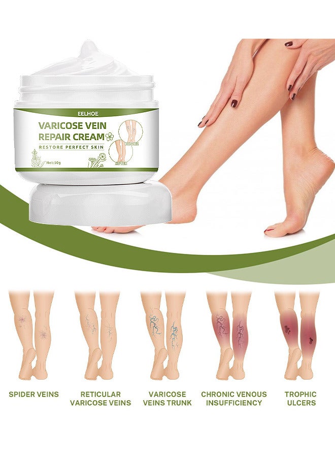 Varicose Veins Repair Cream, Spider Veins Repair Cream, Strengthen Capillary Health, Varicose Vein Treatment Cream For Legs, Improve Blood Circulation, Tired And Heavy Legs 50G