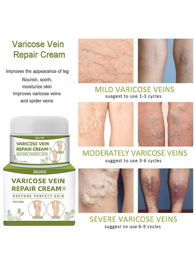 Varicose Veins Repair Cream, Spider Veins Repair Cream, Strengthen Capillary Health, Varicose Vein Treatment Cream For Legs, Improve Blood Circulation, Tired And Heavy Legs 50G