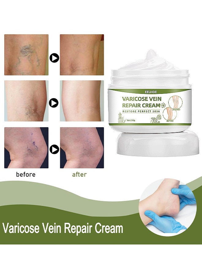 Varicose Veins Repair Cream, Spider Veins Repair Cream, Strengthen Capillary Health, Varicose Vein Treatment Cream For Legs, Improve Blood Circulation, Tired And Heavy Legs 50G