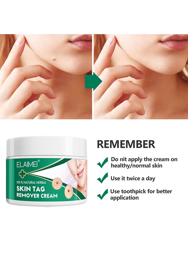 Fast And Effective Skin Tag Remover Cream And Painless Natural Formula, Smoothes Skin Gentle Fast Acting Gel Wart Removal For Plantar Wart Flat Warts And Corns, 100 % Natural Herbal