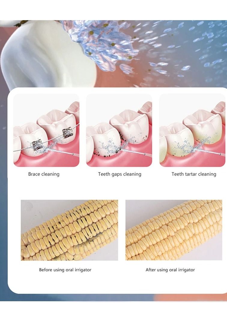 Portable Dental Water Flosser Clean Teeth Cordless Professional Dental Oral Irrigator 300Ml Water Tank