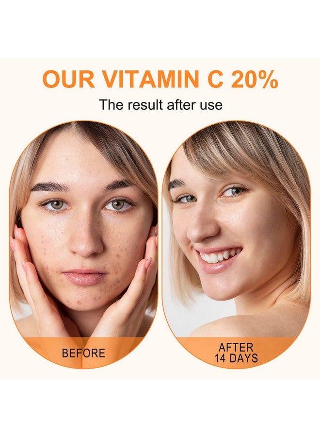 Premium 20% Vitamin C Serum For Face With Hyaluronic Acid Retinol & Amino Acids Boost Skin Collagenhydrate & Plump Skin Anti Aging & Wrinkle Facial Serum 60Ml