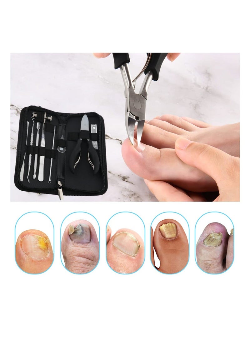 10Pcs/Set Ingrown Toenail Tools Kit, Nail Treatment Foot Tool,Ingrown Removal Correction Clippers, Surgery Grade File Lifter, Professional Pedicure Tool whit Storage Package