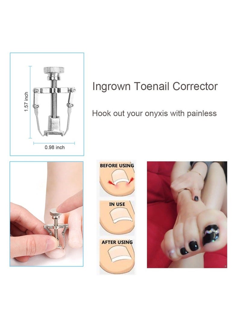 10Pcs/Set Ingrown Toenail Tools Kit, Nail Treatment Foot Tool,Ingrown Removal Correction Clippers, Surgery Grade File Lifter, Professional Pedicure Tool whit Storage Package