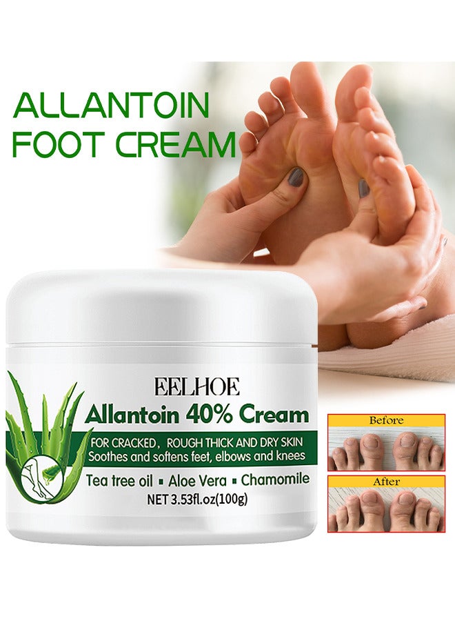 Foot Care Cream Allantoin 40% Cream For Cracked, Rough Thick And Dry Skin Soothes And Softens Feet, Elbows And Knees Hydrating And Moisturizing Foot Care Cream