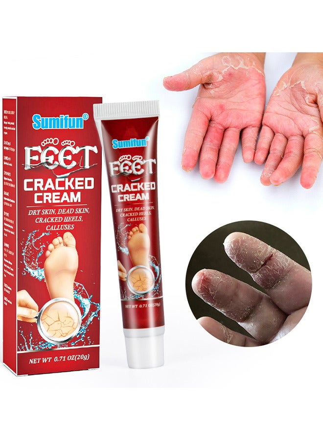 Foot Cracked Cream, Anti-Cracking Moisturizing Foot And Hand Cream Beauty, Intensive Foot Repair Cream, Skin Healing Ointment For Cracked Heels And Dry Feet 20G