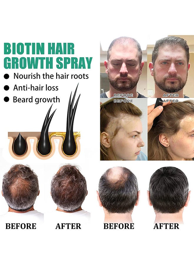 Biotin Hair Regrowth Serum Spray, Hair Essential Spray, Biotin Thickening Herbal Serum, Anti Hair Loss Serum For Hair Growth And Hair Loss, Hair Regrowth For Thicker Longer Fuller Hair