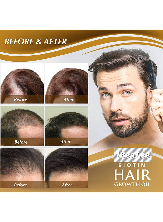 Biotin Hair Regrowth Serum Spray, Hair Essential Spray, Biotin Thickening Herbal Serum, Anti Hair Loss Serum For Hair Growth And Hair Loss, Hair Regrowth For Thicker Longer Fuller Hair