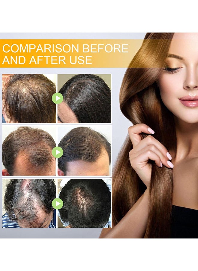 Biotin Hair Regrowth Serum Spray, Hair Essential Spray, Biotin Thickening Herbal Serum, Anti Hair Loss Serum For Hair Growth And Hair Loss, Hair Regrowth For Thicker Longer Fuller Hair