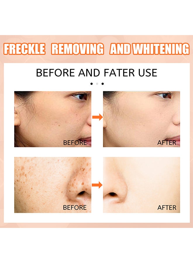 Whiteing Freckle Cream VC Brightening And Whitening Spot Removing Cream Spot Removing Pen Removing Stains And Dark Spots Pen Improving Skin Tone Brightening And Whitening Spot Removing Cream