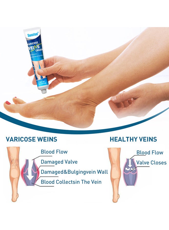 Varicose Vein Cream For Legs, Improves Blood Circulation, Reduces Spider Veins And Heaviness, Improve Blood Circulation, Tired And Heavy Legs, 20G