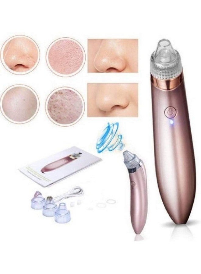Zamkar 4 In 1 Xn8030 Rechargeable Blackhead Whitehead Remover Device(Assorted Color)