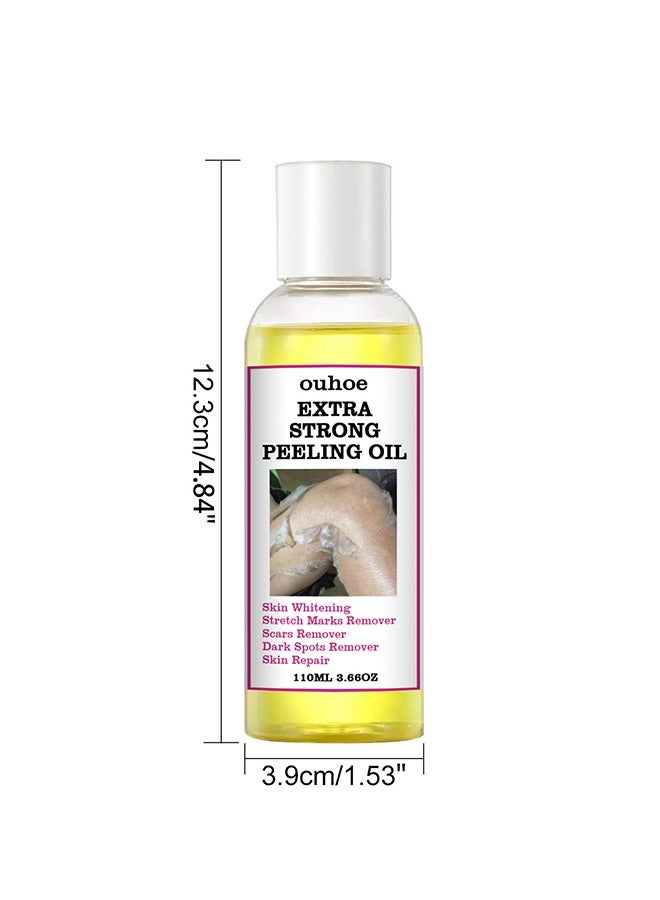 Extra Strong Peeling Oil,Skin Whitening Stretoh Marks Remover Peeling Solution With Salicylic Acid, Dark Spot Corrector For Body, Skin Brightening Solution For Dull Skin (110Ml)