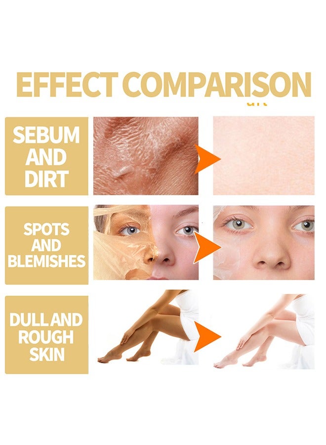 Extra Strong Peeling Oil,Skin Whitening Stretoh Marks Remover Peeling Solution With Salicylic Acid, Dark Spot Corrector For Body, Skin Brightening Solution For Dull Skin (110Ml)