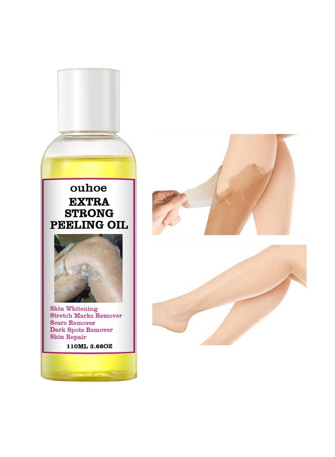 Extra Strong Peeling Oil,Skin Whitening Stretoh Marks Remover Peeling Solution With Salicylic Acid, Dark Spot Corrector For Body, Skin Brightening Solution For Dull Skin (110Ml)