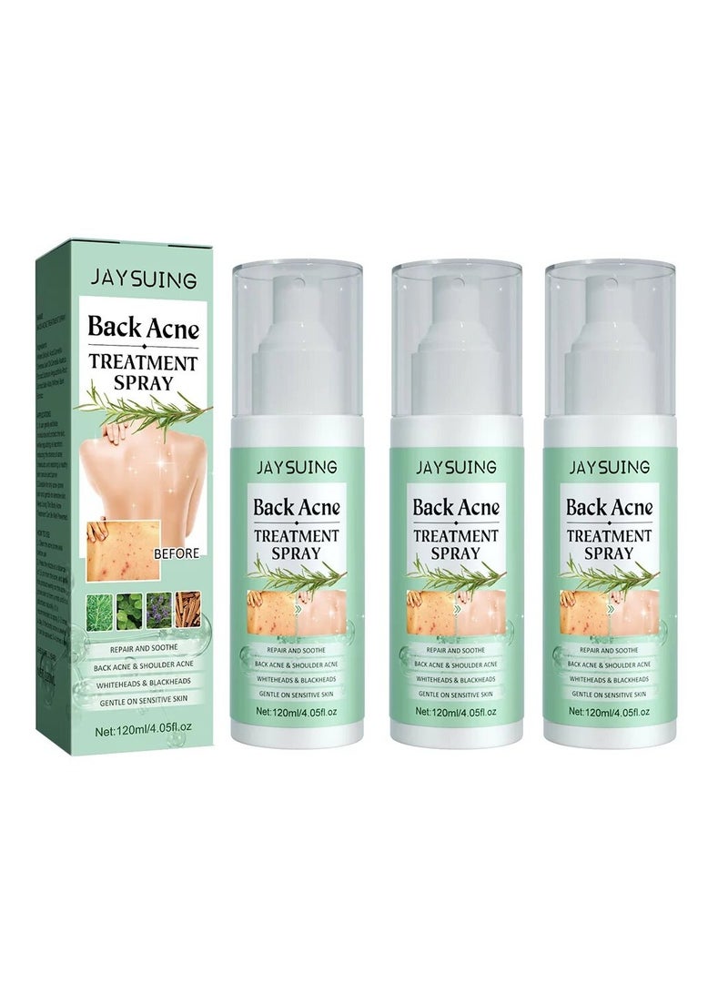 Back Acne Lighten Acne Marks Repair Back Shoulder Acne Skin Care spray 120ml Pack Of 3