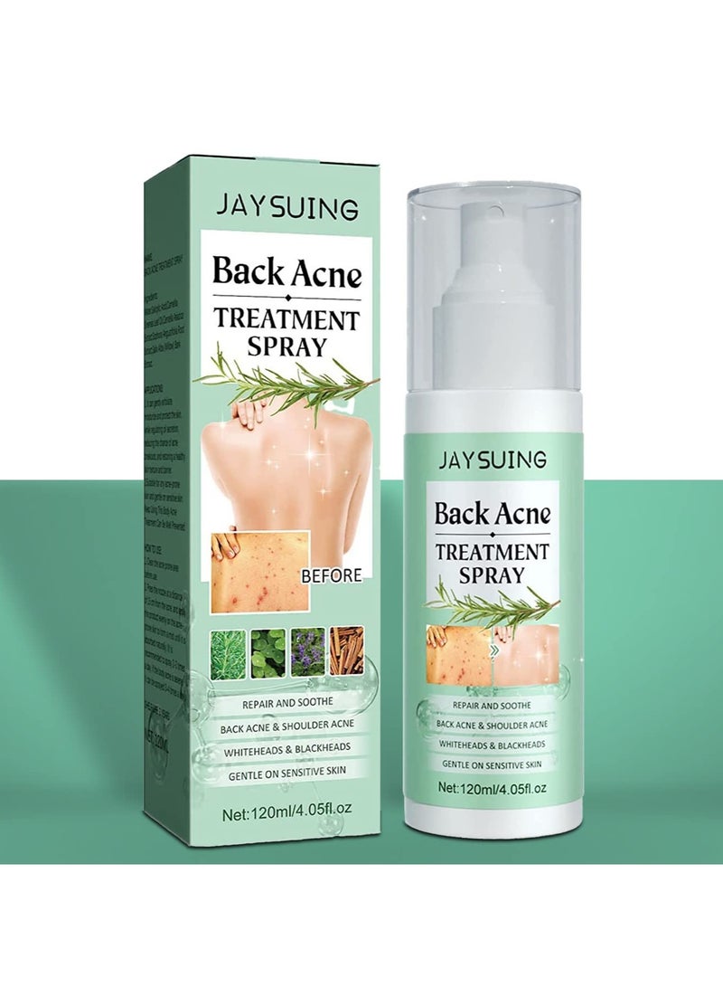 Back Acne Lighten Acne Marks Repair Back Shoulder Acne Skin Care spray 120ml