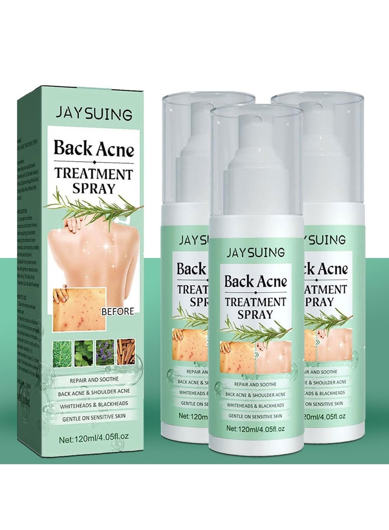 Back Acne Lighten Acne Marks Repair Back Shoulder Acne Skin Care spray 120ml Pack Of 3