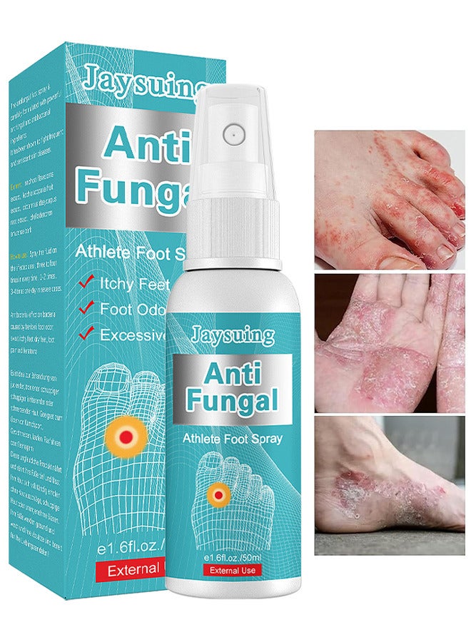 Anti Fungal Athletes Foot Treatment Spray, Anti-Fungi Treatment For Feet Itchy, Sweating, Peeling And Blisters, Natural Ingredients Foot Fungi Spray For Tinea Pedis 50ML