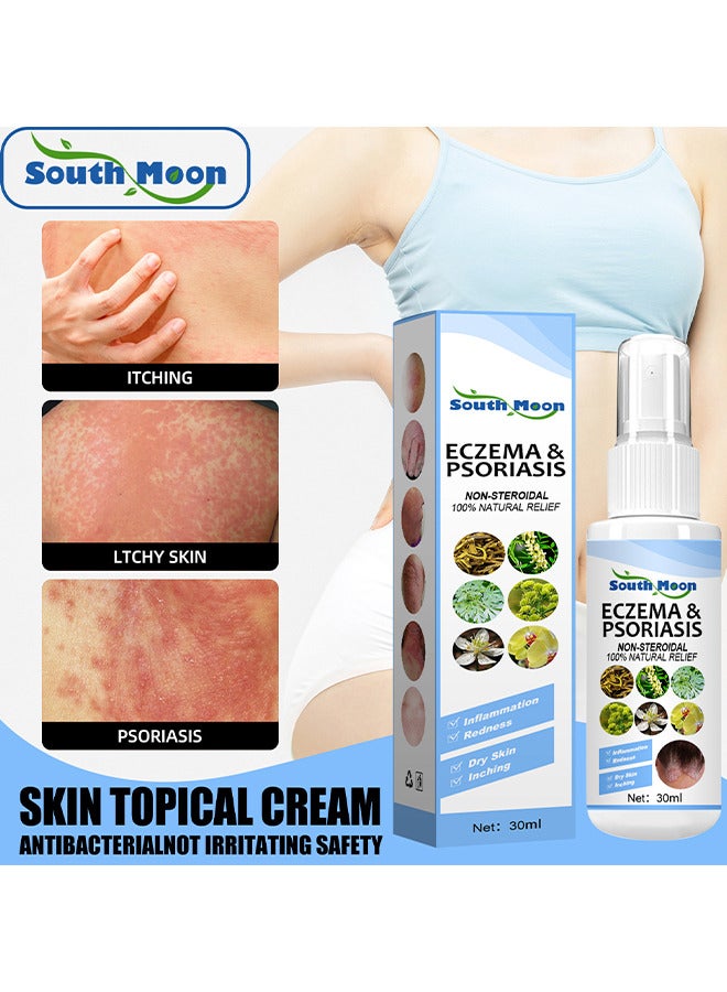 Natural Chinese Herbal Eczema And Psoriasis Spray, Dermatitis And Eczema Pruritus Psoriasis Spray, Say Goodbye To Scaly Skin, Eczema Relief Spray, Stops Burning And Itching 30ML