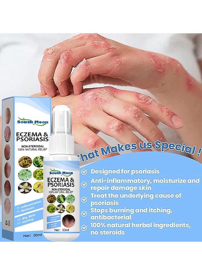 Natural Chinese Herbal Eczema And Psoriasis Spray, Dermatitis And Eczema Pruritus Psoriasis Spray, Say Goodbye To Scaly Skin, Eczema Relief Spray, Stops Burning And Itching 30ML