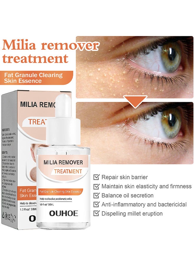 Milia Removal Treatment, Milia Spot Treatment Helps Dissolve And Reduce Milia, Whitehead And Sebaceous Hyperplasia, Cysts And Sebaceous Hyperplasia Face Serum 30 ML