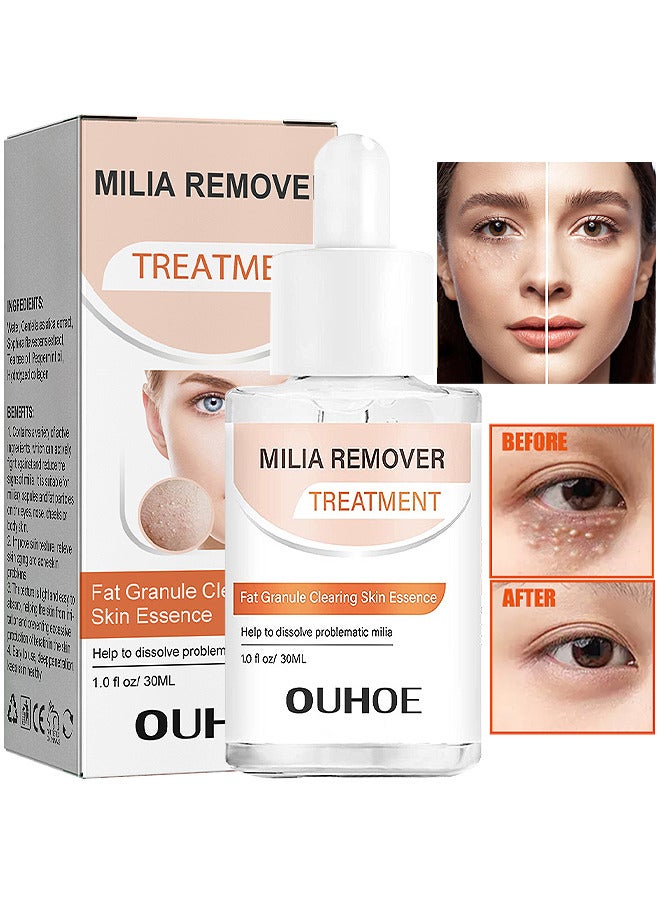 Milia Removal Treatment, Milia Spot Treatment Helps Dissolve And Reduce Milia, Whitehead And Sebaceous Hyperplasia, Cysts And Sebaceous Hyperplasia Face Serum 30 ML