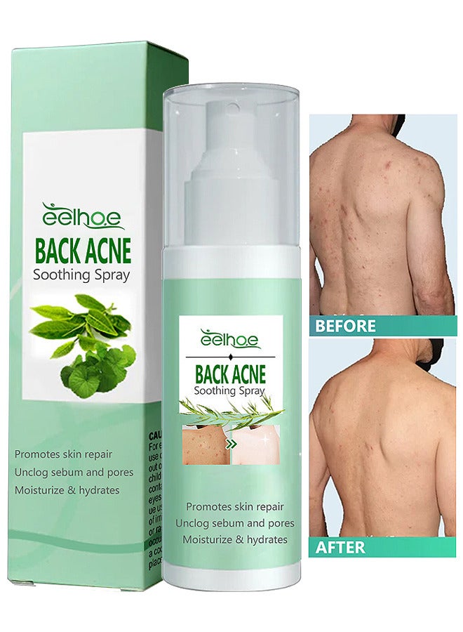 120ML Back Acne Treatment Soothing Spay, Back Acne Spray, Niacinamide Spray, Body Acne Treatment with Herbal Formula, Tea Tree Oil Spray, Body Acne Treatment Spray For Teens, Gentle On Skin