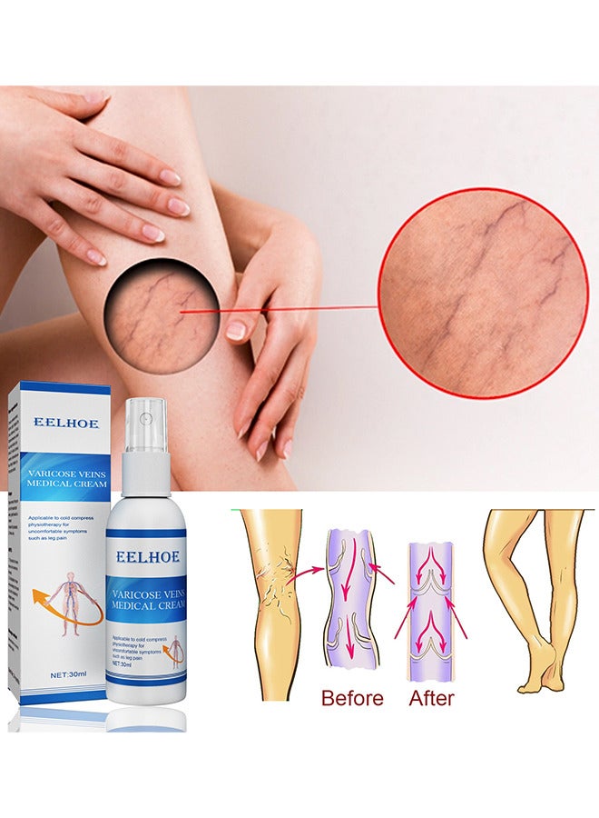 Varicose Veins Medical Cream, Eliminate And Spider Veins Spray, Varicose Veins Relief, Improve Blood Circulation, Soothes Tired Legs, Antiedema, Improve Blood Circulatio Quickly Soothing Swelling 30ML