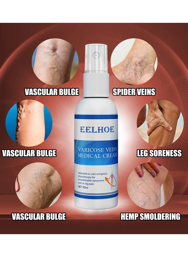 Varicose Veins Medical Cream, Eliminate And Spider Veins Spray, Varicose Veins Relief, Improve Blood Circulation, Soothes Tired Legs, Antiedema, Improve Blood Circulatio Quickly Soothing Swelling 30ML