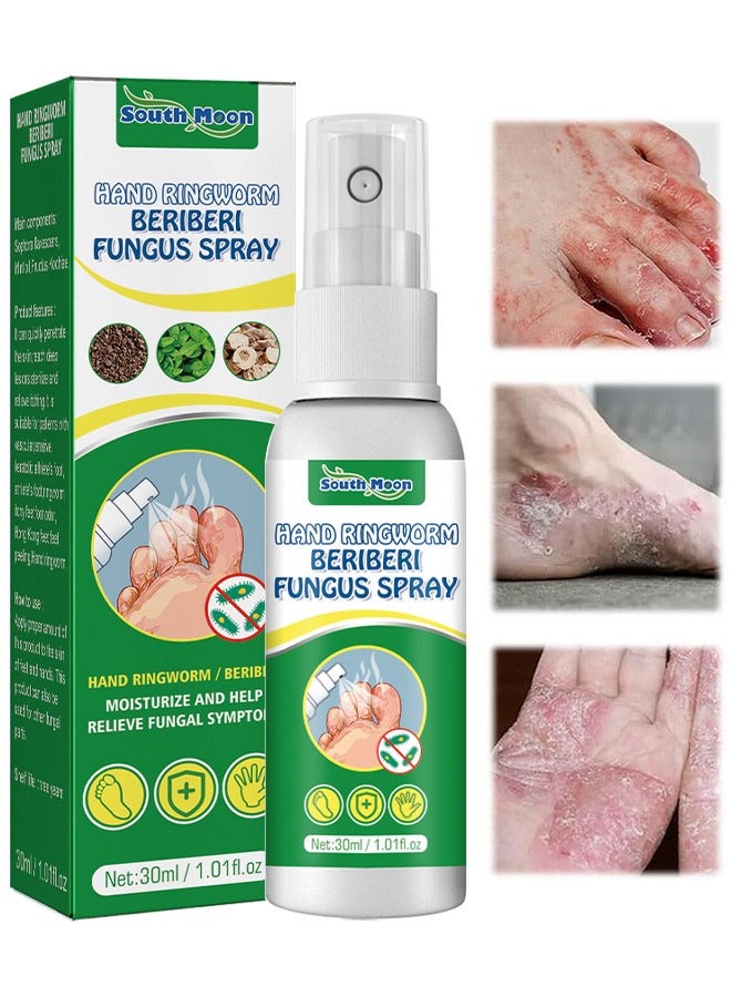 Hand Ringworm BeriBeri Fungus Spray, Anti-Fungi Treatment For Feet Itchy, Sweating, Peeling And Blisters, Natural Ingredients Foot Fungi Spray For Tinea Pedis, Inflamed, Feet Smelly 30ML