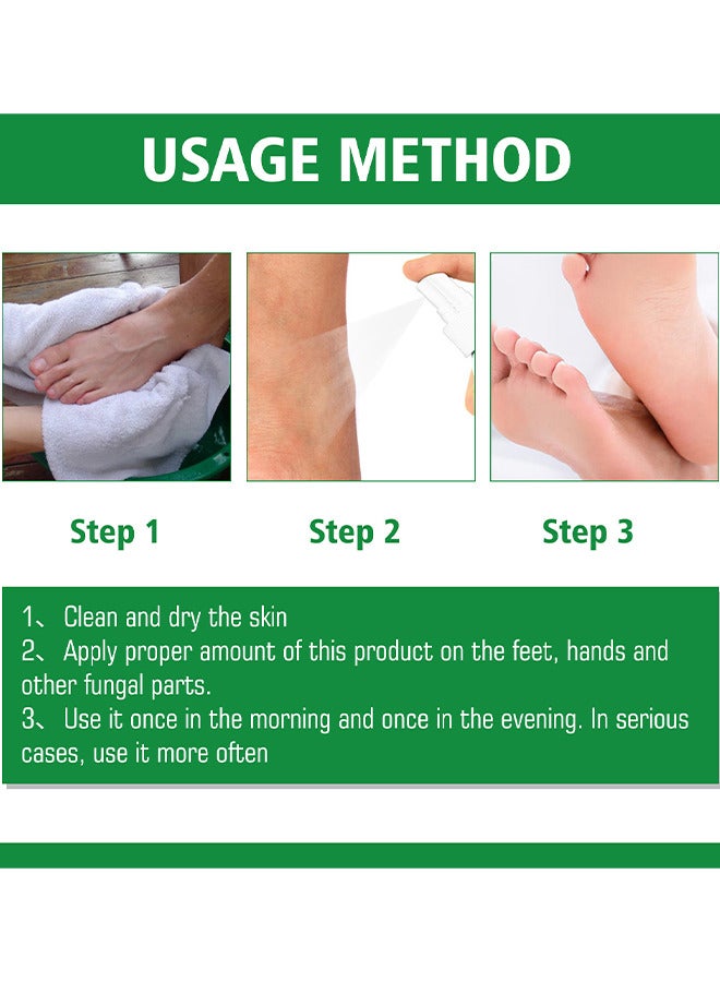 Hand Ringworm BeriBeri Fungus Spray, Anti-Fungi Treatment For Feet Itchy, Sweating, Peeling And Blisters, Natural Ingredients Foot Fungi Spray For Tinea Pedis, Inflamed, Feet Smelly 30ML