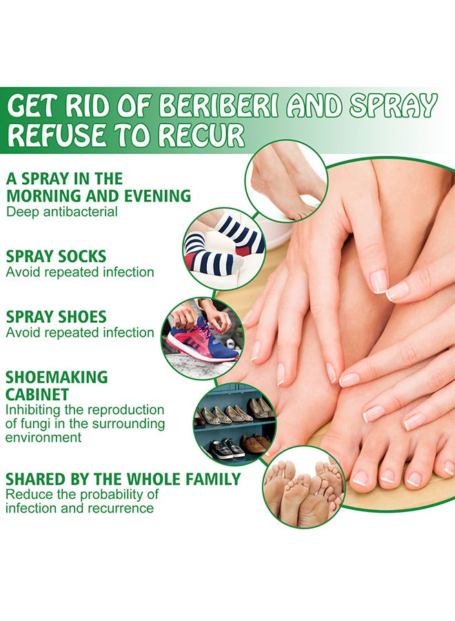 Hand Ringworm BeriBeri Fungus Spray, Anti-Fungi Treatment For Feet Itchy, Sweating, Peeling And Blisters, Natural Ingredients Foot Fungi Spray For Tinea Pedis, Inflamed, Feet Smelly 30ML