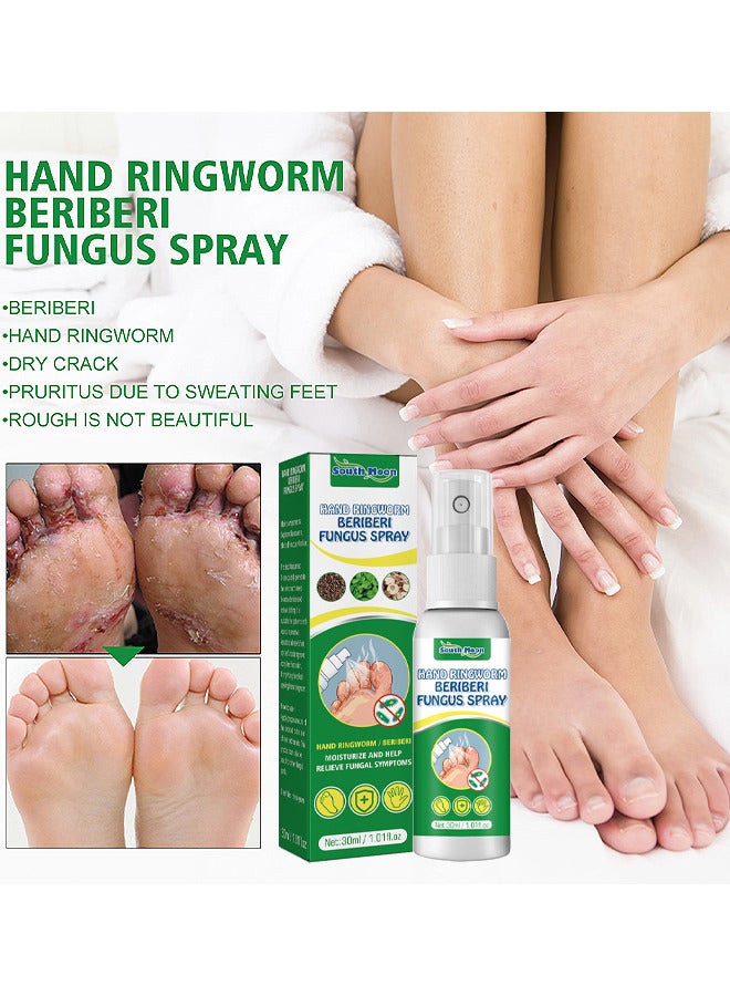 Hand Ringworm BeriBeri Fungus Spray, Anti-Fungi Treatment For Feet Itchy, Sweating, Peeling And Blisters, Natural Ingredients Foot Fungi Spray For Tinea Pedis, Inflamed, Feet Smelly 30ML