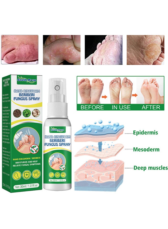 Hand Ringworm BeriBeri Fungus Spray, Anti-Fungi Treatment For Feet Itchy, Sweating, Peeling And Blisters, Natural Ingredients Foot Fungi Spray For Tinea Pedis, Inflamed, Feet Smelly 30ML