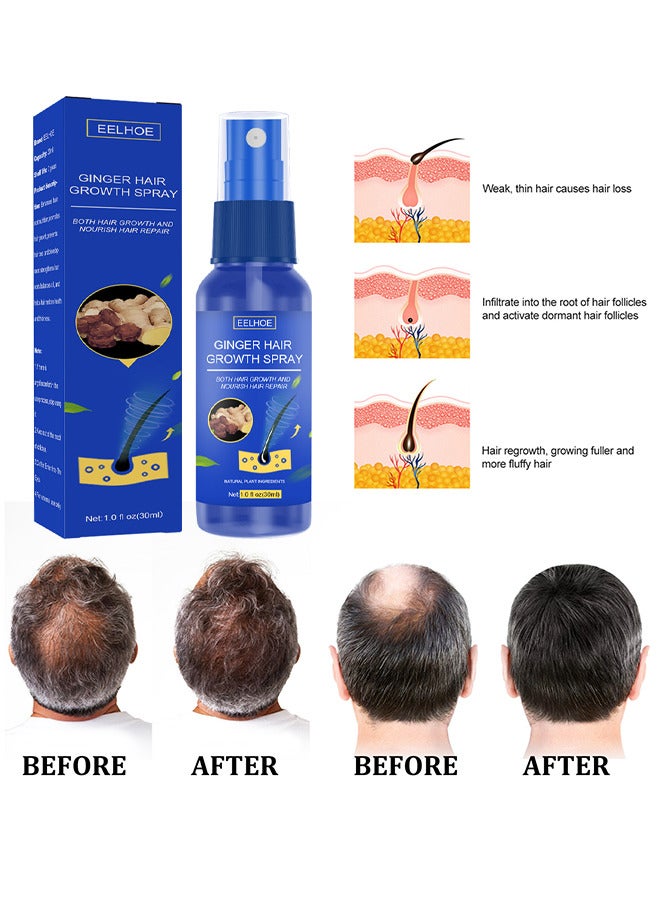 Ginger Hair Growth Spray, Regrowth Nourishing Ginger Spray, Ginger Spray For Hair Growth, Anti Hair Loss, Thinning, Balding, Repairs Hair, Use For Hair Loss and Hair Thinning Treatment Spray 30ML