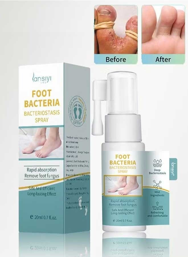 Foot Beriberi Deodorization Bacteriostasis Spray 20ml, Foot Care Spray, Treatment Of Foot Itching And Foot Odor, Deodorant And Antibacterial Foot Odor Spray To Relieve Odor Sweat Feet
