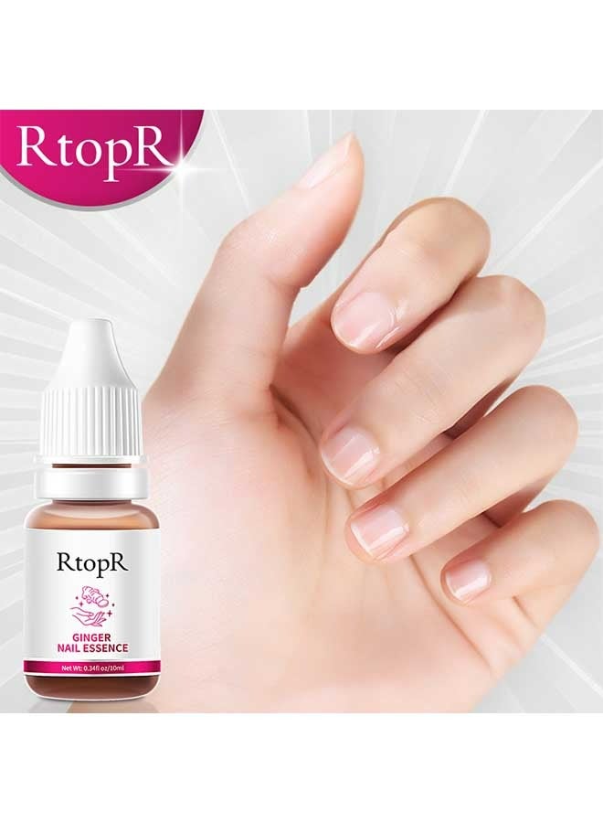Ginger Nail Repair Essence 10ml, Has Antifungal And Antibacterial Properties, Relieves Nail Infections, And Promotes Nail Healing, Nail Treatment Healthy Nails