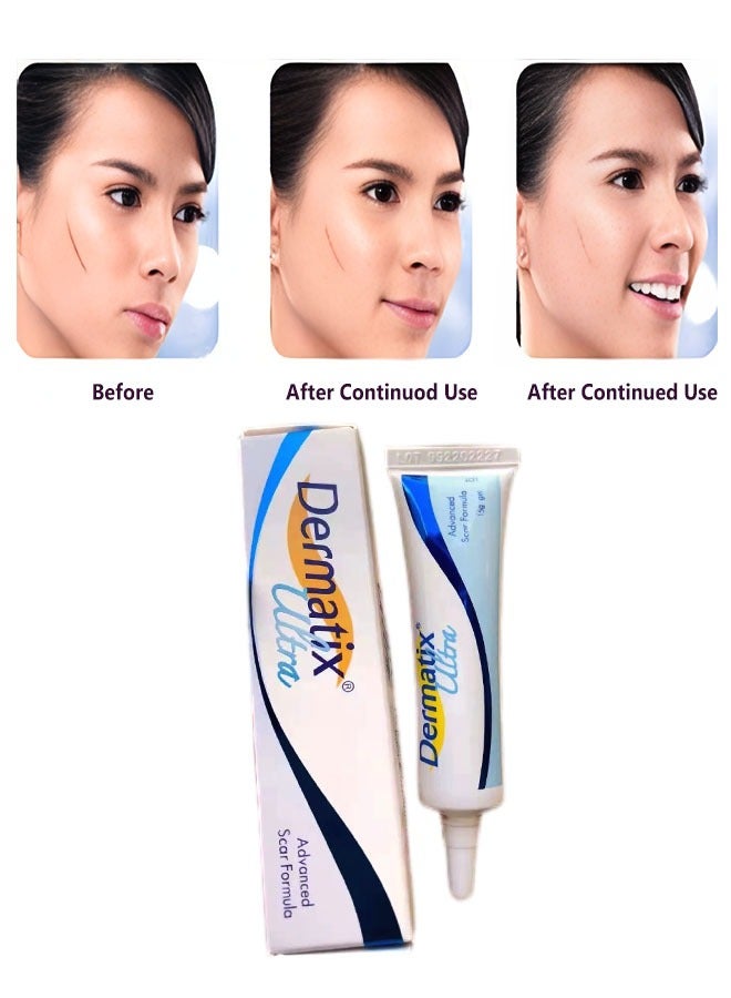 Advanced Scar Gel 15g For Cosmetic Improvement of Scars, Fast Drying and Unique Silicone Gel Formulation, Used For Treatment of Keloids, Surgical and Hypertrophic Scars, Suitable For Sensitive Skin