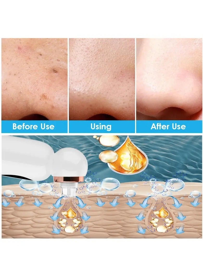 USB Rechargeable Electric Bubble Blackhead Remover - Water Cycle Pore Acne Pimple Removal Vacuum Suction Facial Cleaner Tool
