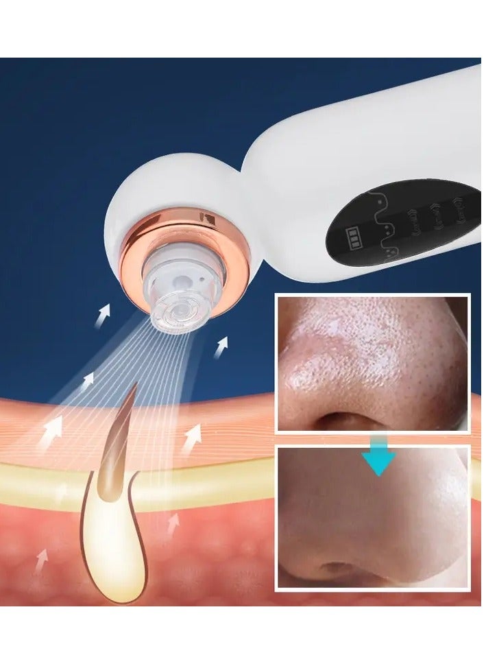 USB Rechargeable Electric Bubble Blackhead Remover - Water Cycle Pore Acne Pimple Removal Vacuum Suction Facial Cleaner Tool