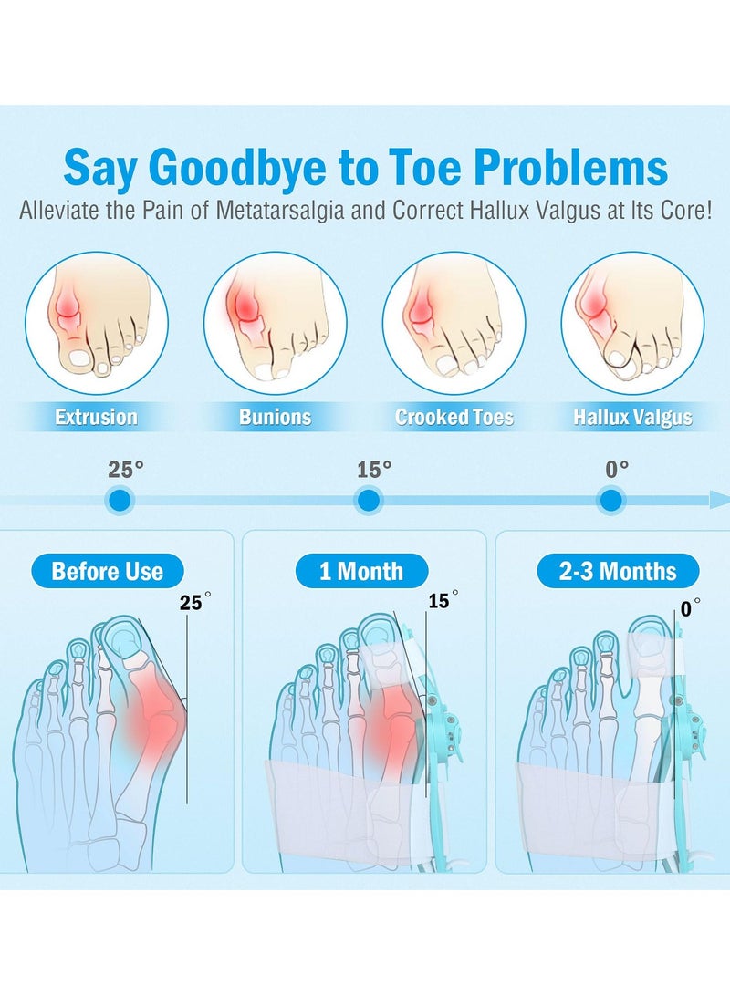 Bunion Corrector for Women & Men, Big Toe Adjustable Knob Bunion Splint for Bunion Relief, Orthopedic Toe Straightener with Anti-slip Heel Strap, Suitable for Left and Right Feet