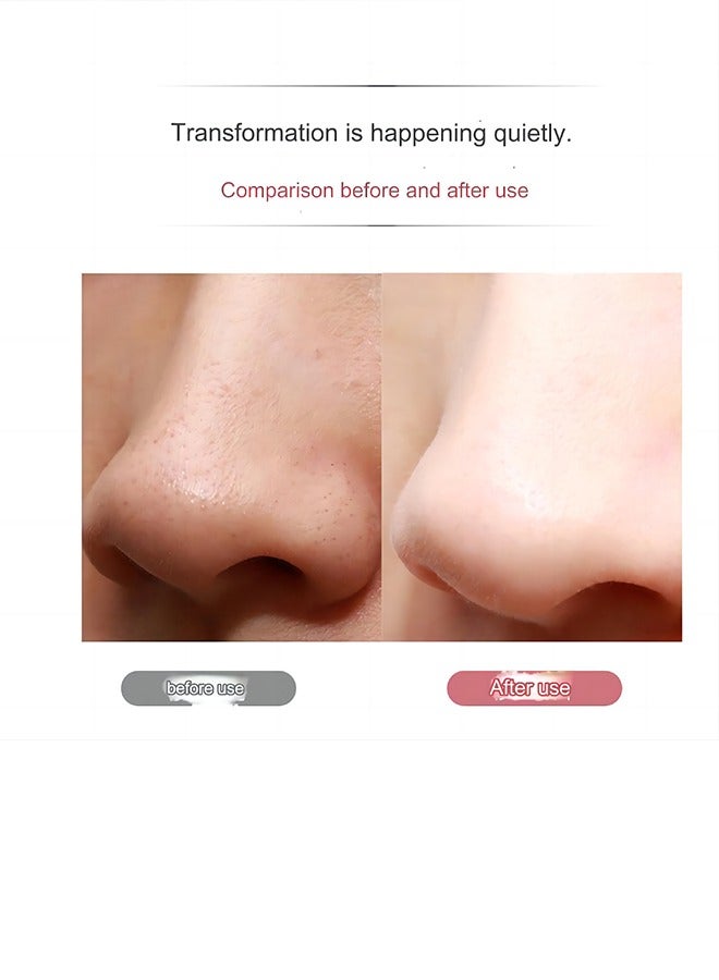 Skin Cleaner Facial Scraper, Skin Scraper Pore Cleaner Blackhead Removal Tool for Facial Deep Cleansing - 3 Modes, White